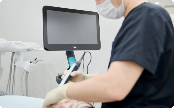 口腔内スキャナー