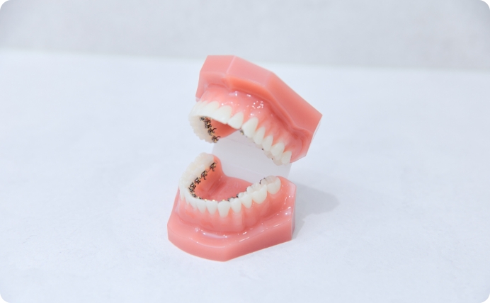 舌側矯正（リンガル矯正）