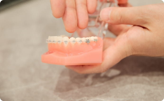 効率的に歯を動かせる