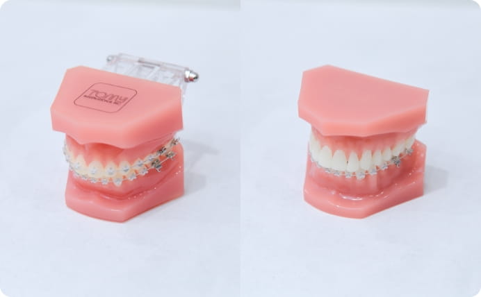 患者さまに合わせた選択肢