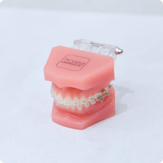 表側矯正（ラビアル矯正）